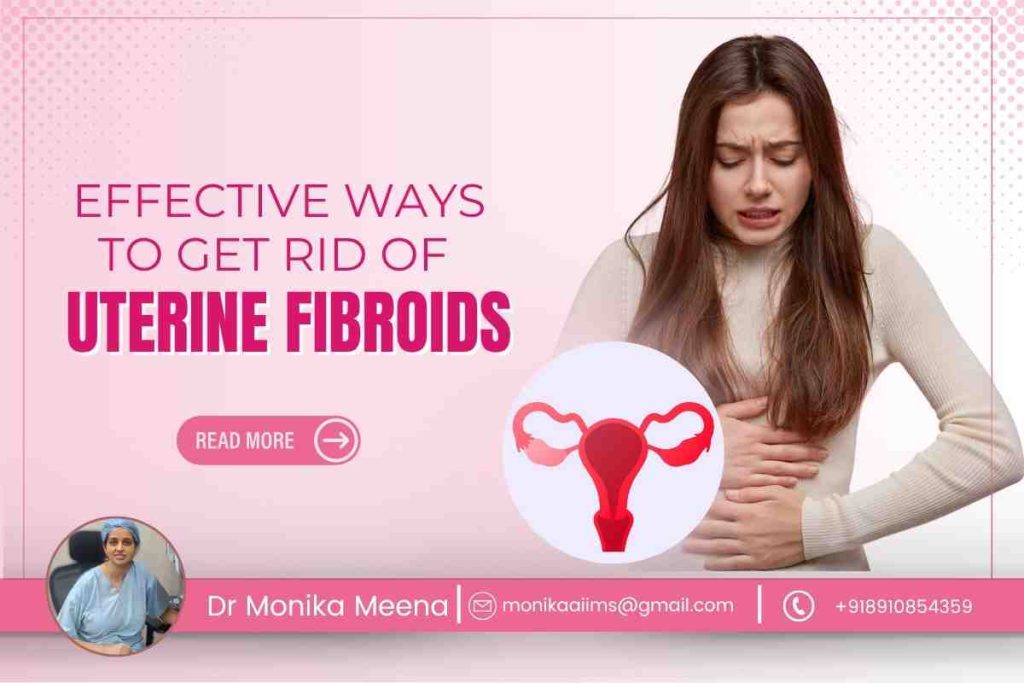How to Get Rid of Uterine Fibroids – Listen to the Top Fibroids Surgeon in Kolkata
