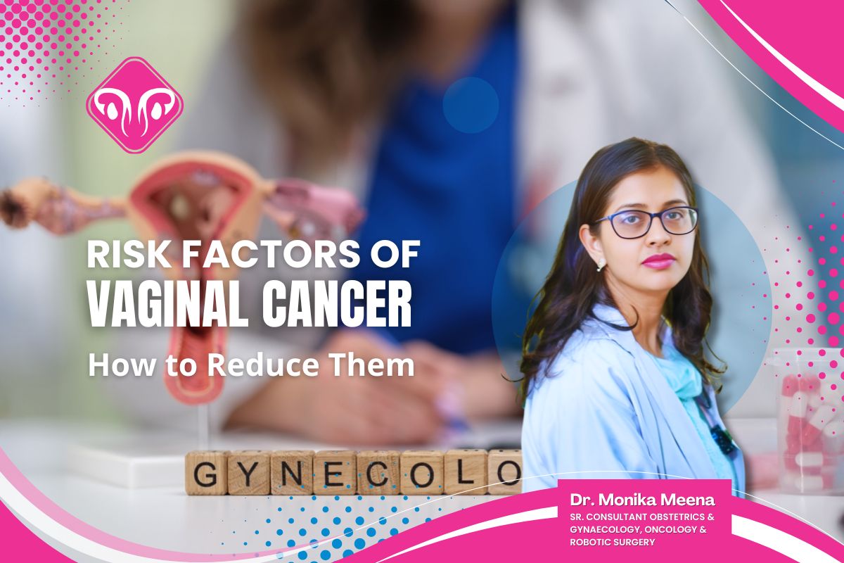 Risk Factors of Vaginal Cancer and How to Reduce Them