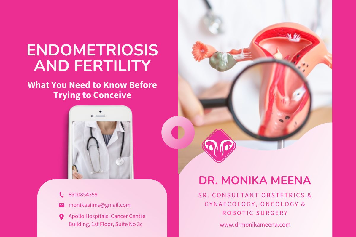 Endometriosis and Fertility: What You Need to Know Before Trying to Conceive